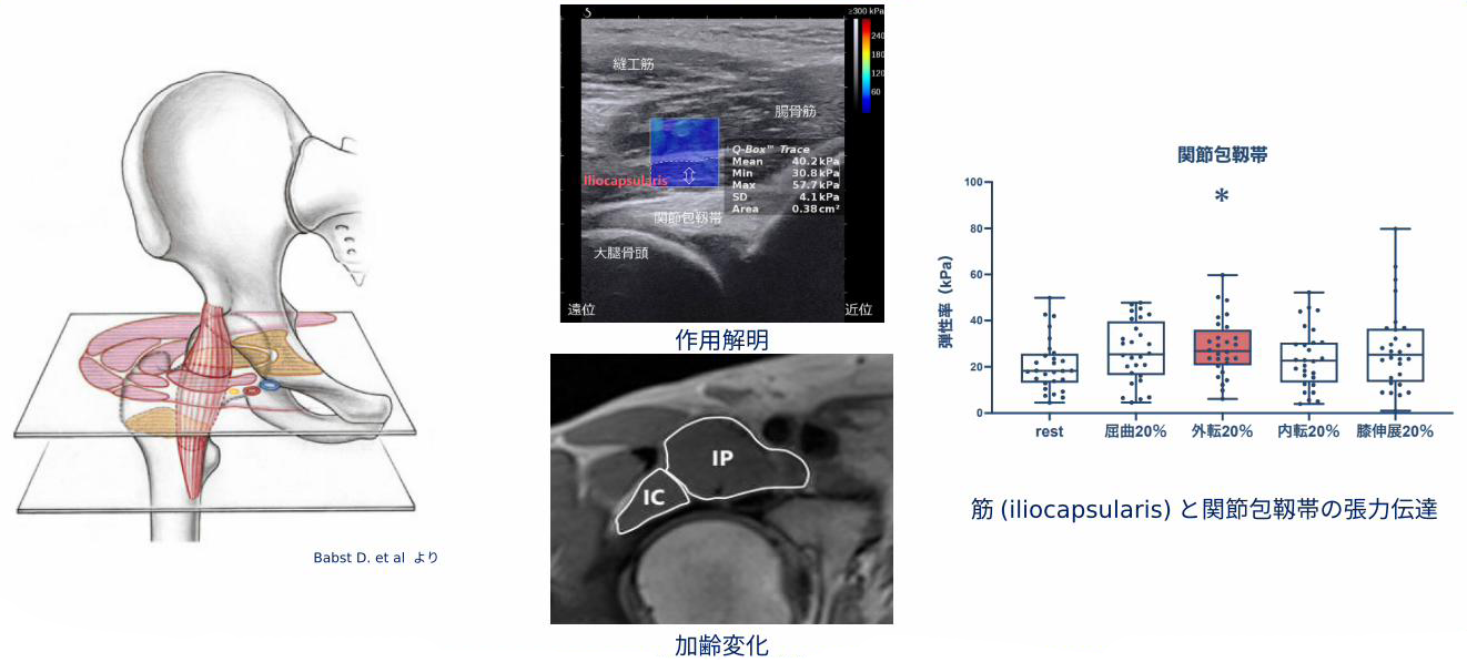 Iliocapsularisに関する研究