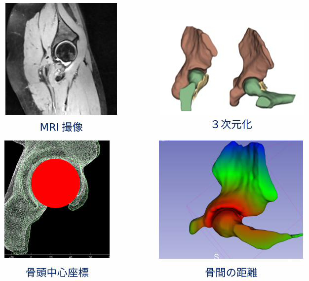 股関節内運動に関する研究