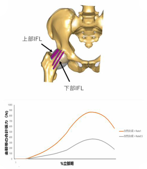 腸骨大腿靭帯のシミュレーション研究
