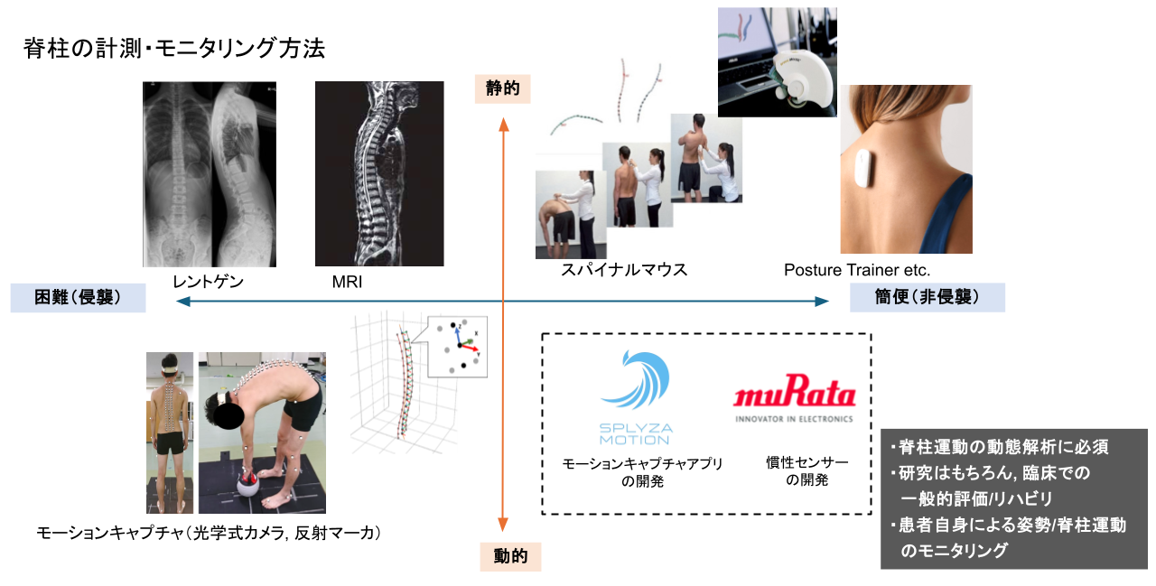 脊柱モニタリングデバイスの開発