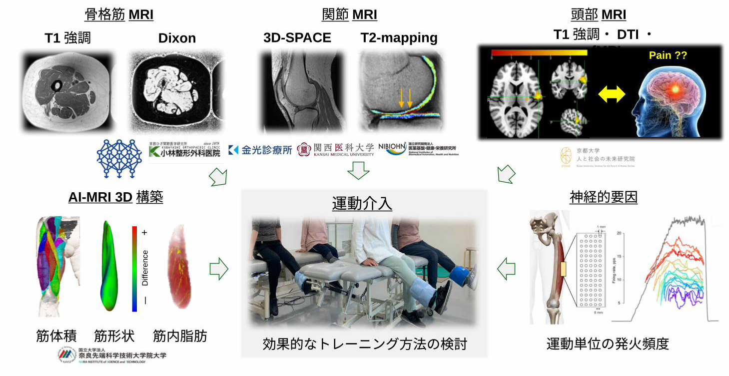 変形性膝関節症患者の筋変性特徴に基づく病態メカニズムの解明